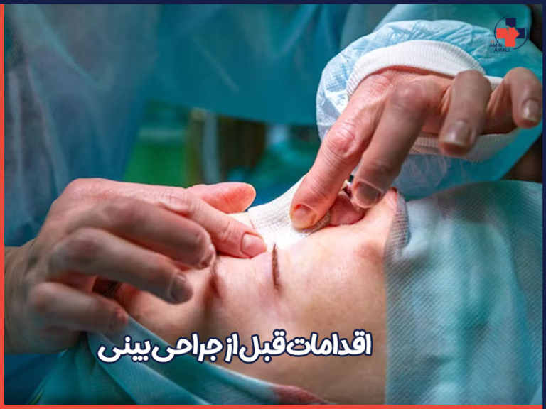 راهنما اقدامات قبل از جراحی بینی - دکتر آمالی