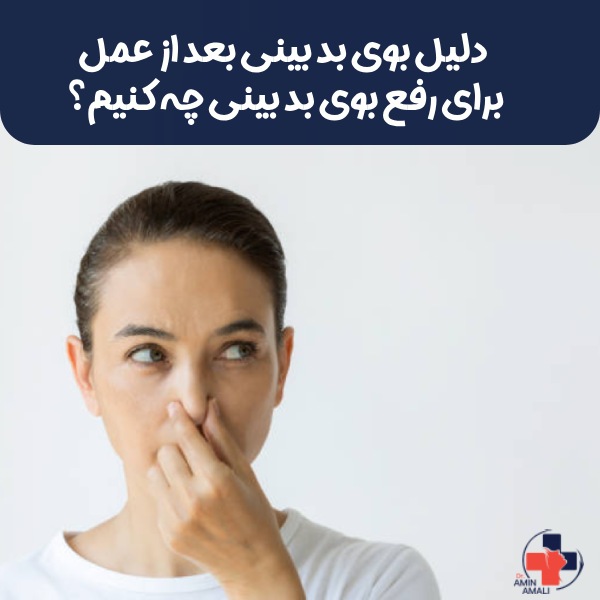 بوی بد بینی بعد از عمل