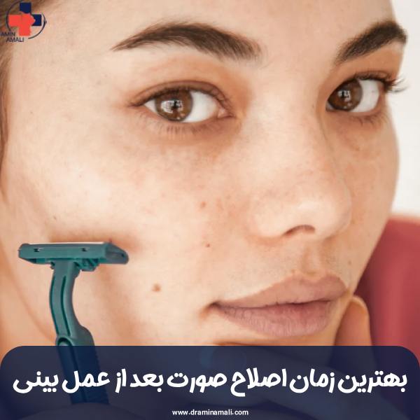بهترین زمان اصلاح صورت بعد از عمل بینی