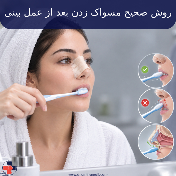 روش صحیح مسواک زدن بعد از عمل بینی؛ چندروز بعد از عمل بینی میشه مسواک زد؟