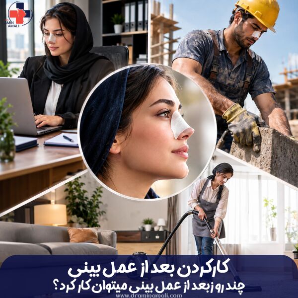 چند روز بعد از عمل بینی میتوان کار کرد؟کارهای ممنوع بعد از عمل بینی